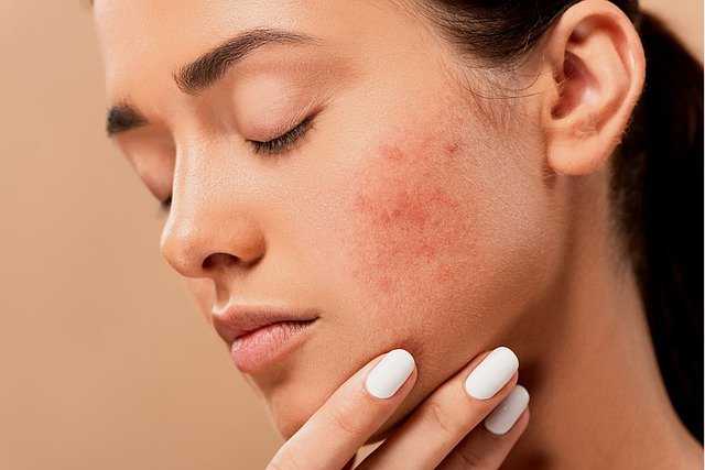 Steps to skin care to boost self-confidence